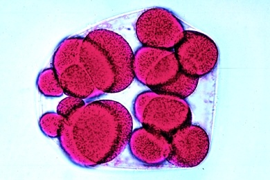 Mikropräparat - Seeigel, Sechzehn-Zellen-Stadium