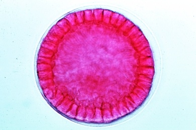 Mikropräparat - Seeigel, Blastula