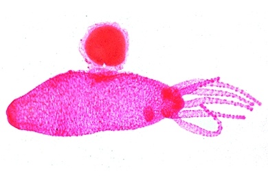 Mikropräparat - Hydra mit Ovarium, quer