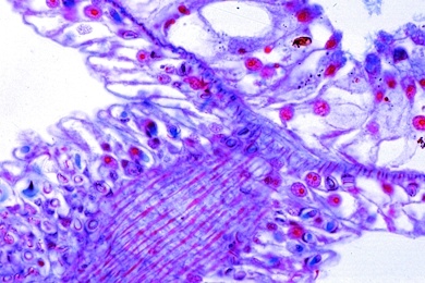 Mikropräparat - Hydra, isolierte Zellen. Darstellung der einzelnen Zelltypen