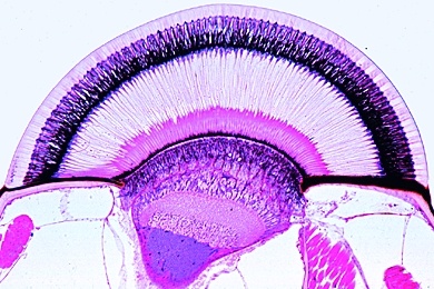 Mikropräparat - Maikäfer, Kopf mit Gehirn und Facettenaugen, Querschnitt