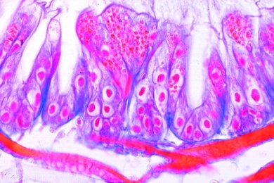 Mikropräparat - Nosema apis, Bienenruhr, Darm einer erkrankten Biene, quer