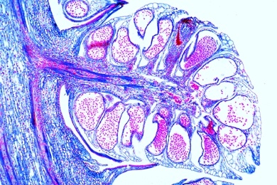 Mikropräparat - Kiefer, männliche Blüte mit Pollen, längs
