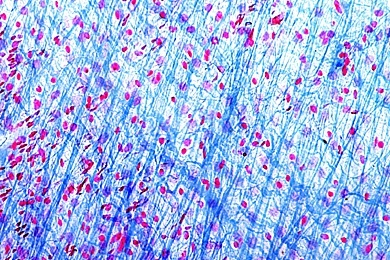 Mikropräparat - Fibrilläres netzförmiges Bindegewebe vom Säugetier. Aufbau aus Fasern und Zellen