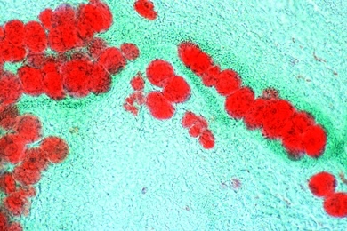 Mikropräparat - Fettgewebe vom Säugetier. Färbung der Fettzellen