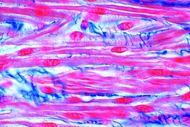 Mikropräparat - Glatte Muskulatur vom Säugetier, quer und längs. Spindelförmige Zellen mit zentral gelegenem Kern