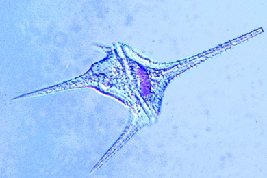 Mikropräparat - Ceratium hirundinella, Panzergeißler