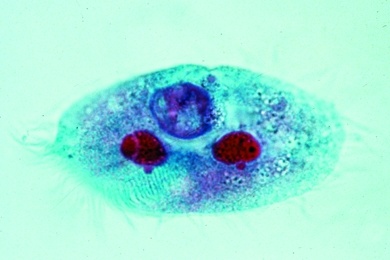 Mikropräparat - Stylonychia, Wimpertierchen