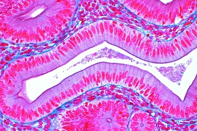 Mikropräparat - Zylinderepithel in der Gallenblase des Menschen, quer