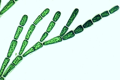 Mikropräparat - Cladophora, Grünalge, Verzweigte Fäden, vielkernige Zellen