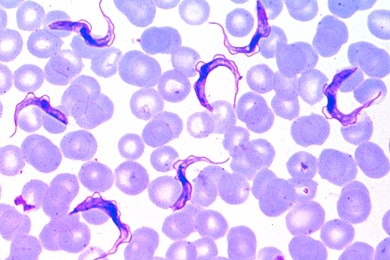 Mikropräparat - Trypanosoma gambiense, Erreger der Schlafkrankheit, Blutausstrich mit Parasiten (Geißeltierchen)