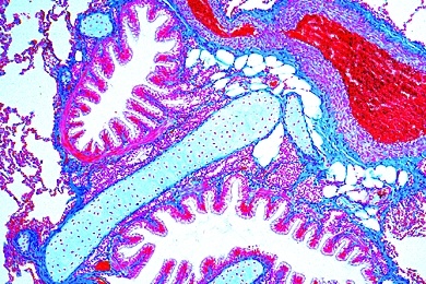 Mikropräparat - Lunge des Menschen, quer, Alveolen, Bronchiolen, Gefäße, Pleura