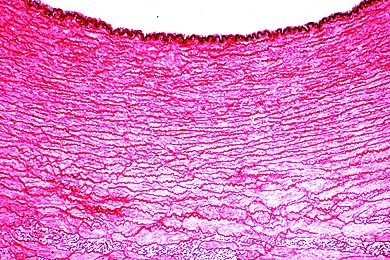 Mikropräparat - Arterie des Menschen, quer, Färbung der elastischen Substanz