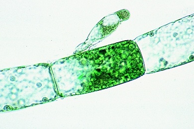 Mikropräparat - Oedogonium, unverzweigte Fadenalge