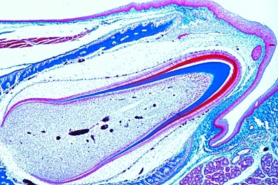 Mikropräparat - Zahnanlage, Embryo vom Mensch, längs