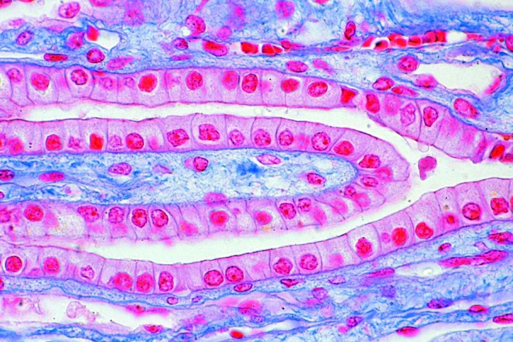 Mikropräparat - Niere der Katze , quer, Rinde mit Malpighischen Körperchen und Mark mit Tubuli