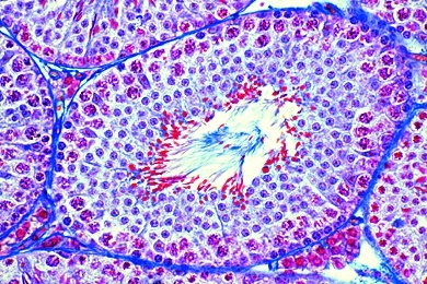 Mikropräparat - Hoden vom Kaninchen, quer, Spermiogenese in allen Stadien