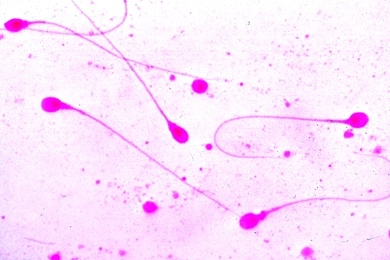 Mikropräparat - Spermatozoen des Menschen, Ausstrich