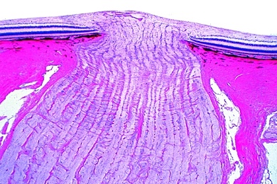 Mikropräparat - Eintritt des Sehnerven im Augenhintergrund der Katze, längs