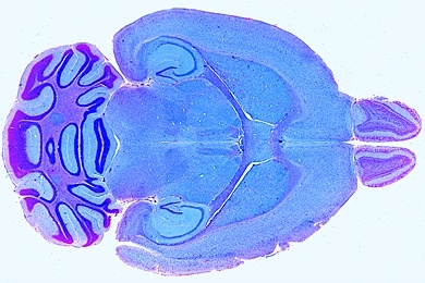 Mikropräparat - Gehirn der Ratte, ganzes Organ, längs