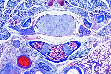 Mikropräparat - Rückenmark mit Wirbelkörper, Ratte, quer