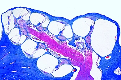 Mikropräparat - Gehörschnecke embryonal, quer