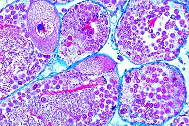 Mikropräparat - Helix pomatia, Weinbergschnecke, Zwitterdrüse quer, Entwicklung von Ei- und Samenzellen