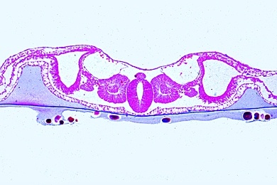 Mikropräparat - Embryo vom Huhn, 48 Stunden alt, quer, Neuralrohr und Chorda, Differenzierungsvorgänge im Mesoderm