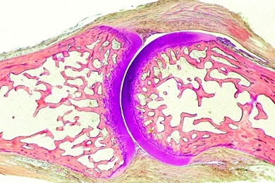 Mikropräparat - Gelenk mit Gelenkkapsel vom Embryo, längs