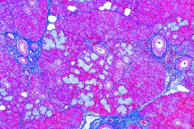 Mikropräparat - Unterkieferspeicheldrüse (Gl, submaxillaris), quer