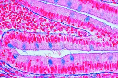 Mikropräparat - Dünndarm (Duodenum), quer, Färbung der Schleimzellen m, PAS-HE