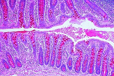 Mikropräparat - Mastdarm (Rectum), quer