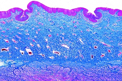 Mikropräparat - Vagina, quer