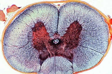 Mikropräparat - Rückenmark, Silberimprägnation nach Golgi (Palmgren)