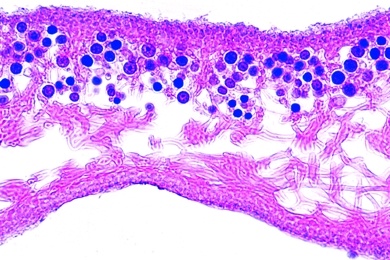 Mikropräparat - Flechte, quer, Thallus mit symbiotischen Algen