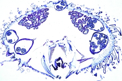 Mikropräparat - Seeigel, Echinus, junges Tier, radial