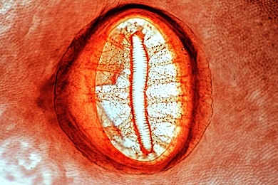 Mikropräparat - Schwimmkäfer, Dytiscus, Atemöffnung (Stigma), in Aufsicht