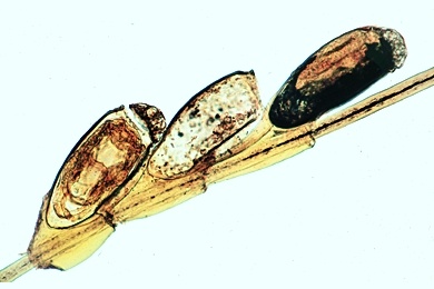 Mikropräparat - Kopflaus, Pediculus capitis, Eier (Nissen) am Haar, total