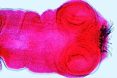 Mikropräparat - Taenia oder Moniezia, Bandwurm, Scolex (Kopf), total
