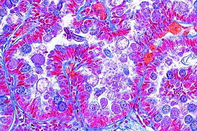 Mikropräparat - Eimeria stiedae, Kaninchenkokzidiose, Schnitt durch die Leber mit Schizogoniestadien, Gameten und Oocysten