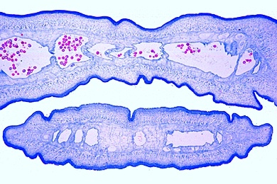 Mikropräparat - Taenia saginata, Rinderbandwurm, Proglottiden in verschiedenen Reifestadien, quer