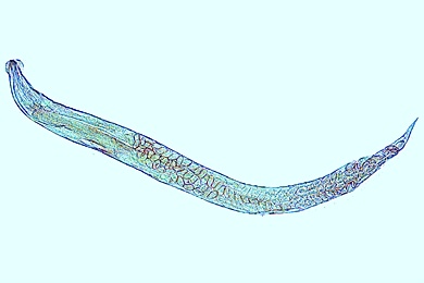 Mikropräparat - Enterobius vermicularis (Oxyuris), Madenwurm, Totalpräparat