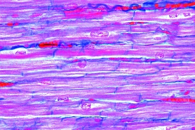Mikropräparat - Herzmuskulatur vom Menschen, quer und längs. Verzweigte Muskelfasern, Glanzstreifen