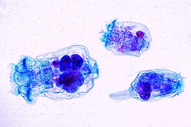 Mikropräparat - Plankton mit Difflugien und Rädertierchen