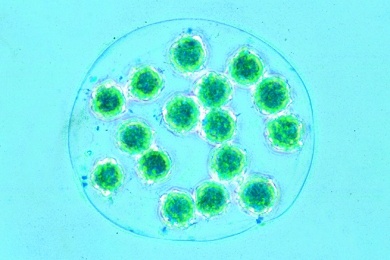 Mikropräparat - Pandorina morum, Grünalge, kugelige Kolonien