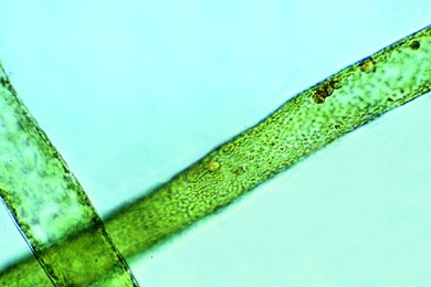 Mikropräparat - Oedogonium, Fadenalge