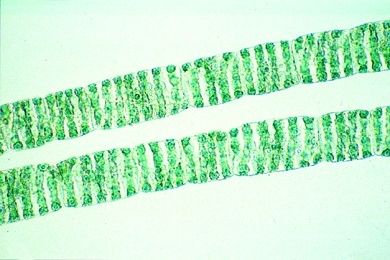Mikropräparat - Jochalgen: Spirogyra, Zygnema, Mougeotia