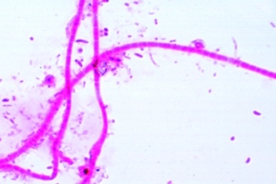 Mikropräparat - Fäulnisbakterien, gemischte Formen