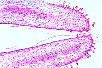 Mikropräparat - Keimende Pollen auf der Narbe von Eschscholtzia, total