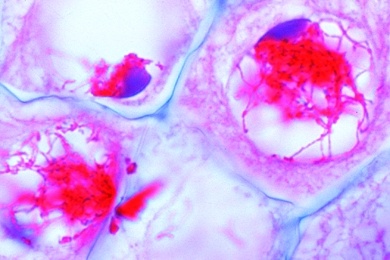 Mikropräparat - Meiose in den Pollenmutterzellen der Lilie (Lilium), 1. Reifeteilung, Leptotän-Zygotän